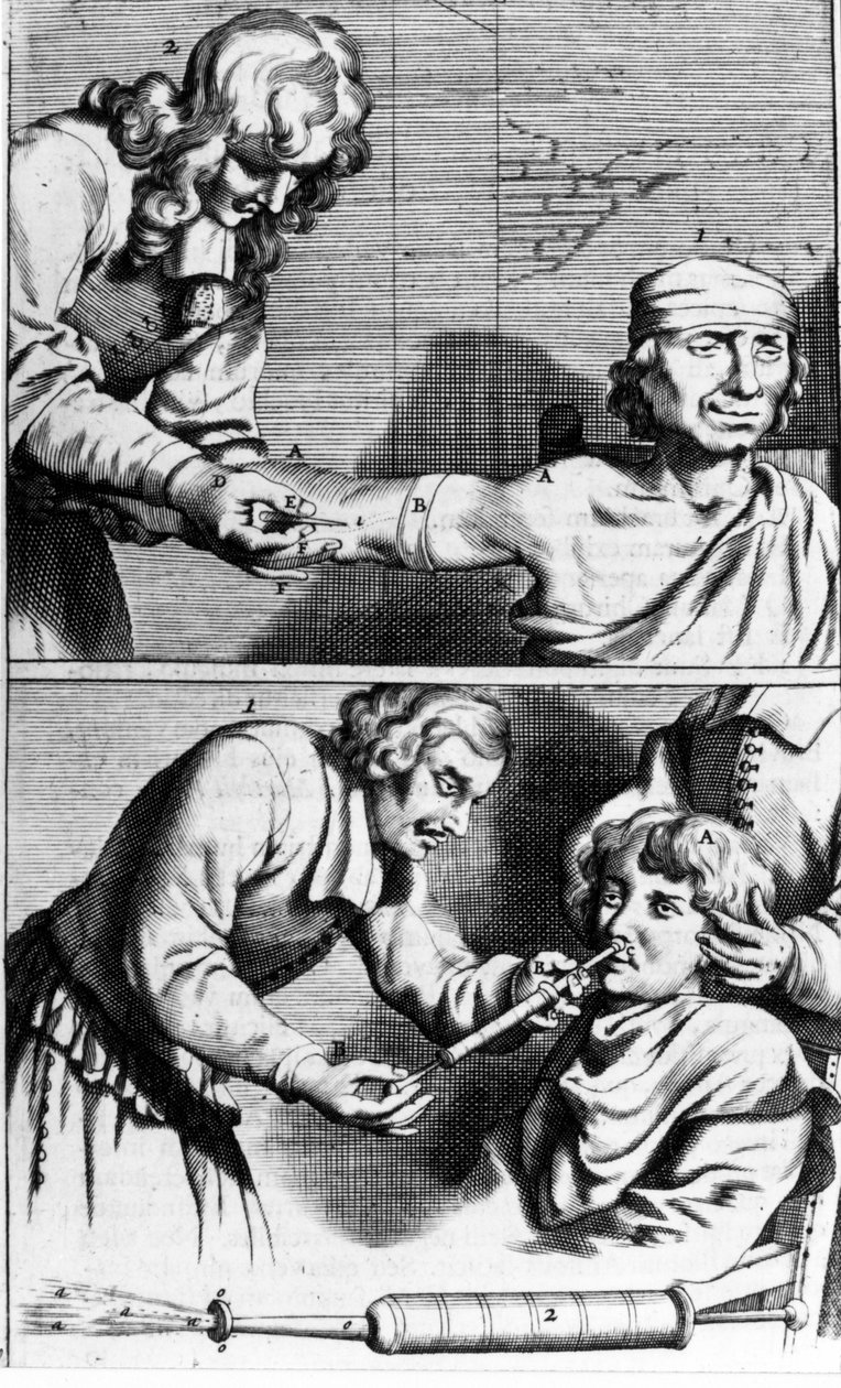 Verenvuoto ja nenäsuihku, Johannes Sculpteti “” Armamentarium Surgery”” Amsterdam 1672 tekijältä Unknown artist