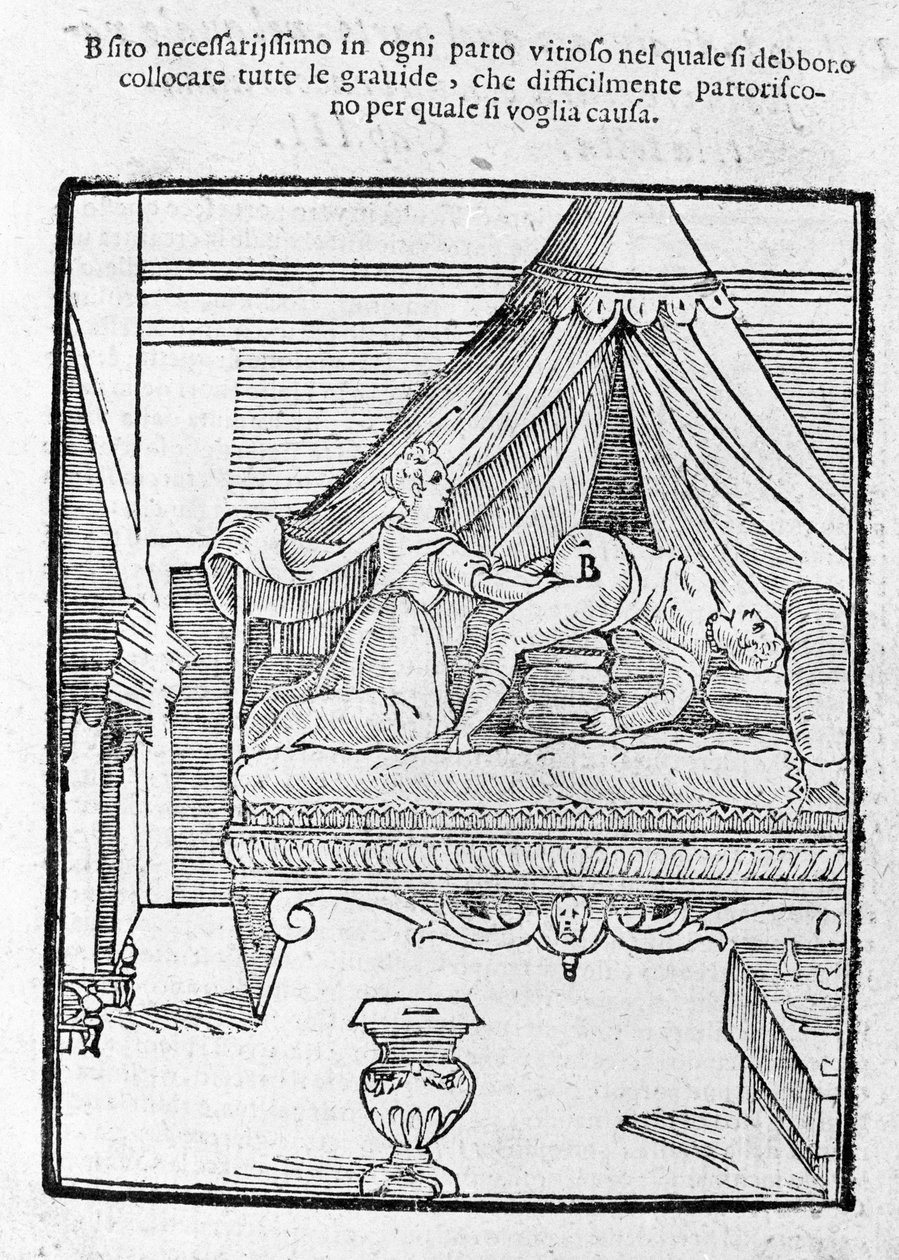 Synnytyskohtaus Scipione Mercurin "Della Commaren" jälkeen tekijältä Unknown artist