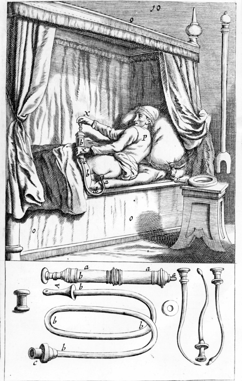 Clystère (peräruiskeille), kirjoittanut Johannes Sculptetus "" Armamentarium Surgical"". Venetsia 1665 tekijältä Unknown artist