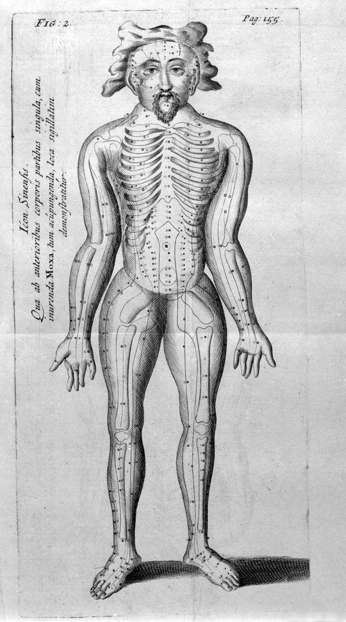 De Acupunctura, kirjoittanut W.Ten Rhijn. Lontoo 1683. Ensimmäinen akupunktiota käsittelevä länsimainen teksti. tekijältä Unknown artist
