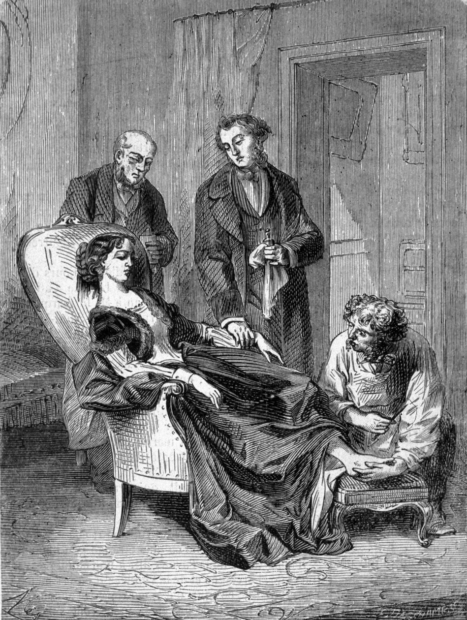 Tyttö Hannah Greenerin kuolemat 15-vuotiaana yhden ensimmäisistä kloroformipuudutuksista 28.1.1848. Kaiverrus vuodelta 1869. tekijältä Unknown artist