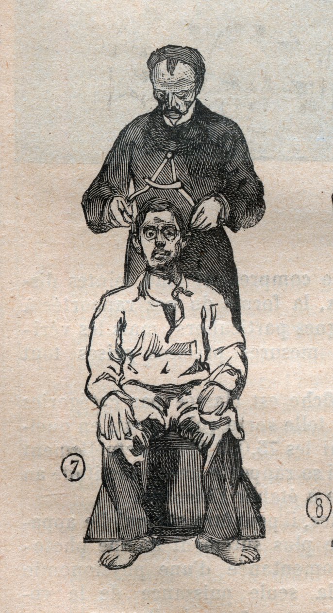 Oikeudellinen antropometria tai bertillonnage, Alphonse Bertillonin (1853-1914) menetelmä: kallon poikittaisen halkaisijan mittaus - Kaiverrus "" La Science francaise -kirjassa" tekijältä Unknown artist