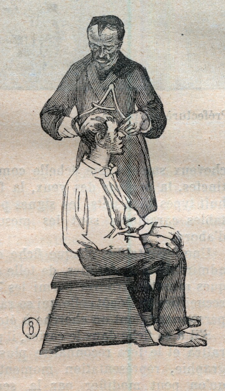 Oikeudellinen antropometria tai bertillonnage, Alphonse Bertillonin (1853-1914) menetelmä: kallon poikittaisen halkaisijan mittaus - Kaiverrus "" La Science francaise -kirjassa" tekijältä Unknown artist