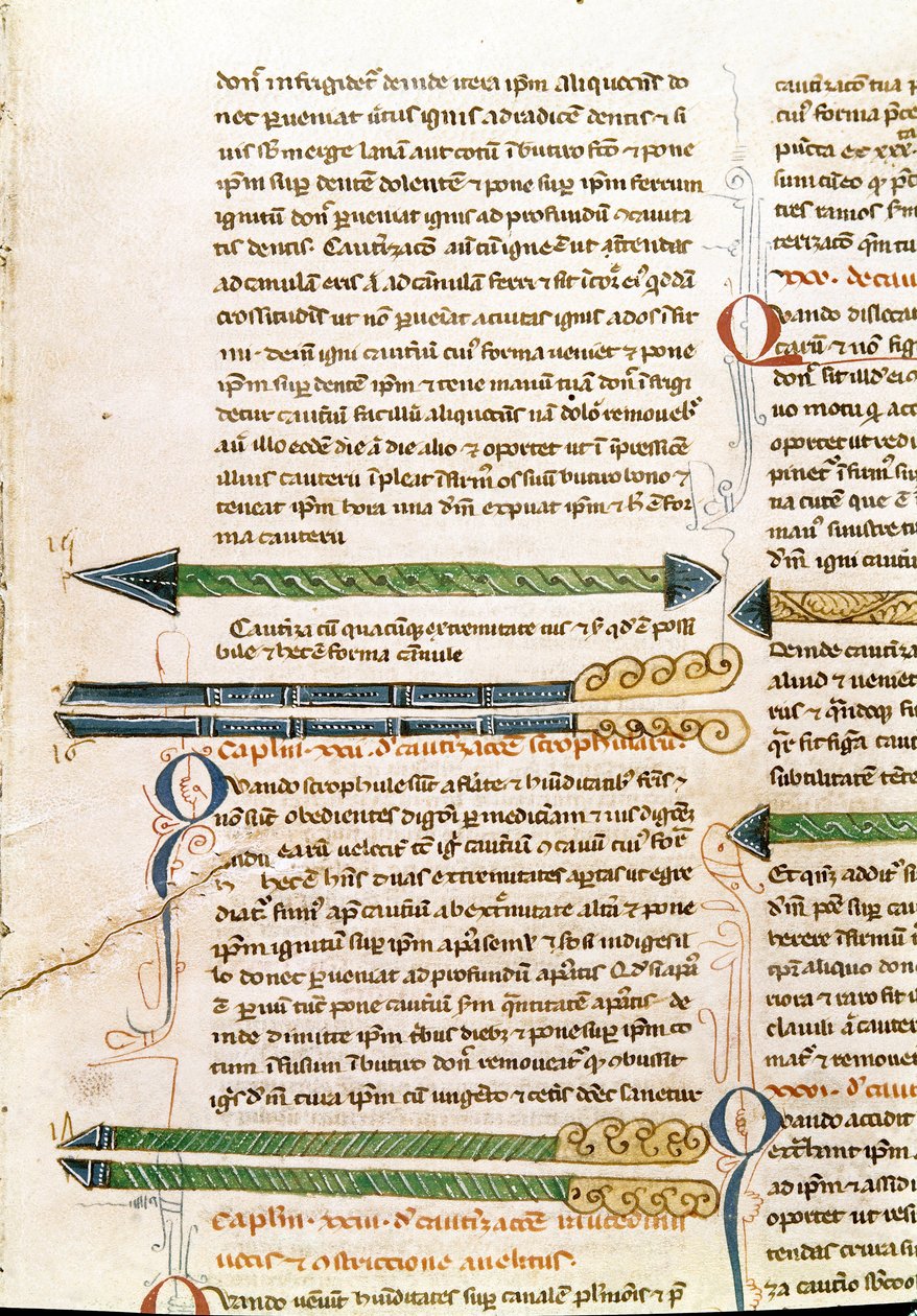 Käsikirjoitussivu "Surgery" (MS. LAT.VII XXXII-3023), kirjoittanut Guillaume de Salice (Guglielmo da Saliceto) (1207-1270) munkki ja lääkäri. 1300-luvun Biblioteca Marciana Venetsia tekijältä Unknown artist