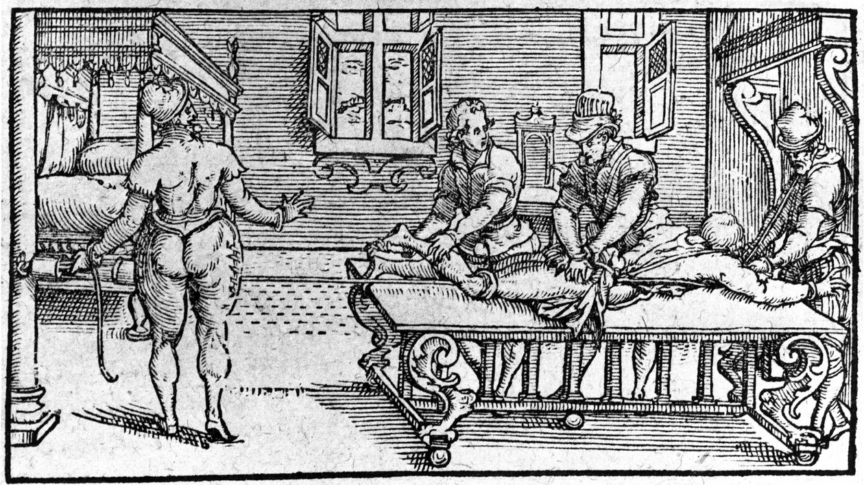 Dislokaation vähentäminen - Ambroise Parén teoksessa "Traité Médical", noin 1560. tekijältä Unknown artist