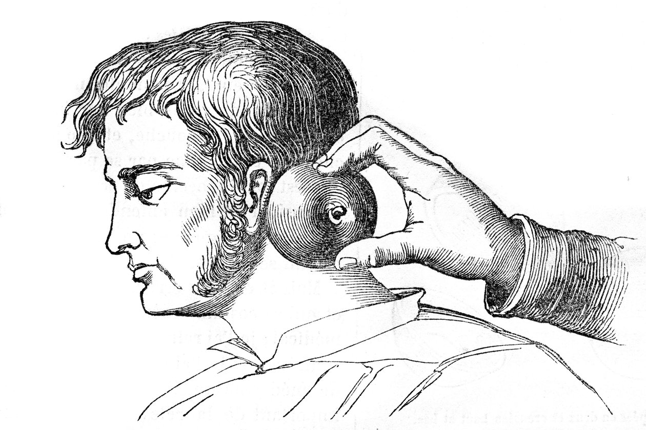 Saignee locales - iilimatojen levitys omenalla - kaiverrus "La Santo Universelle - Medical Guide for Families" 1852 tekijältä Unknown artist