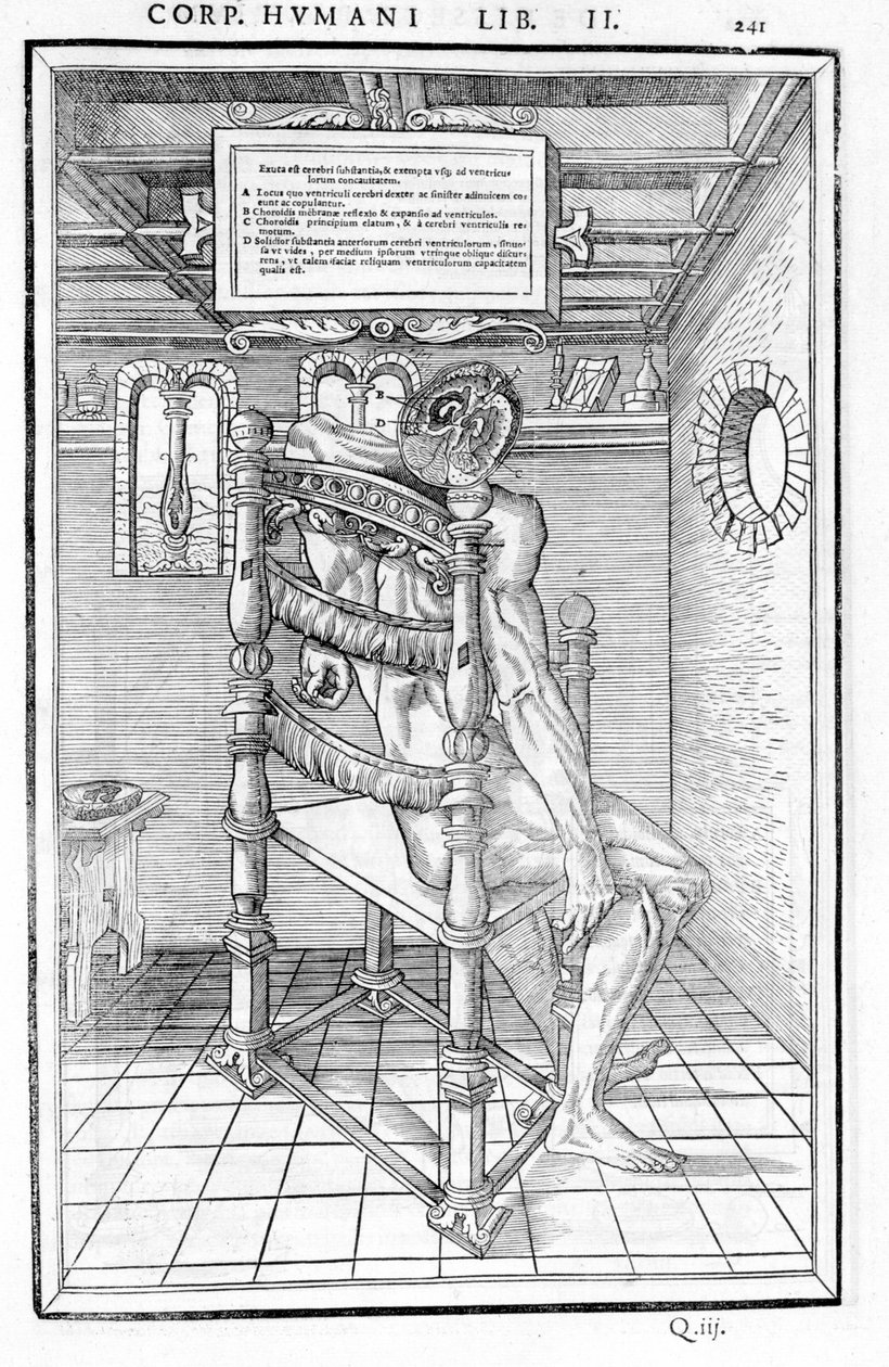 Kallo leikkaus. Anatominen taulu "Ihmiskehon kolmen osan dissektio..." Carlo Stefano Riverio, Pariisi 1545 tekijältä Unknown artist