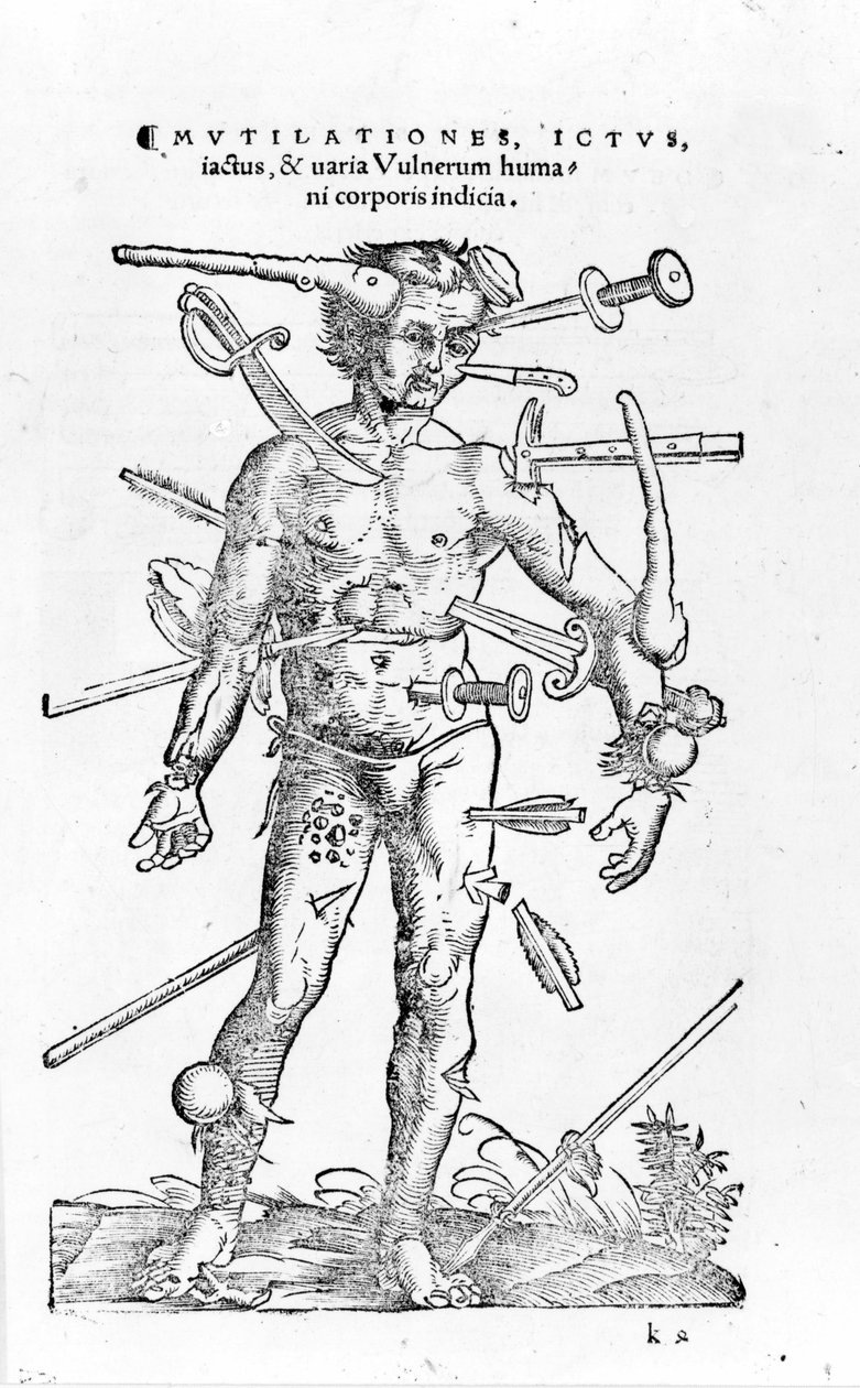 Kaikenlaisia traumaattisia sotavammoja. 16. vuosisata tekijältä Unknown artist