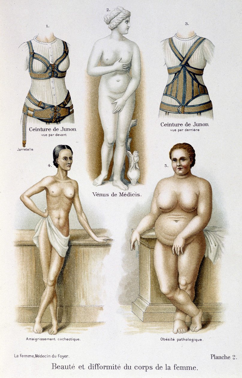 naisen kehon kauneus ja epämuodostumat (laiha ja lihavuus); Junon vyöt - elokuvassa "Nainen, kotilääkäri" tekijältä Unknown artist