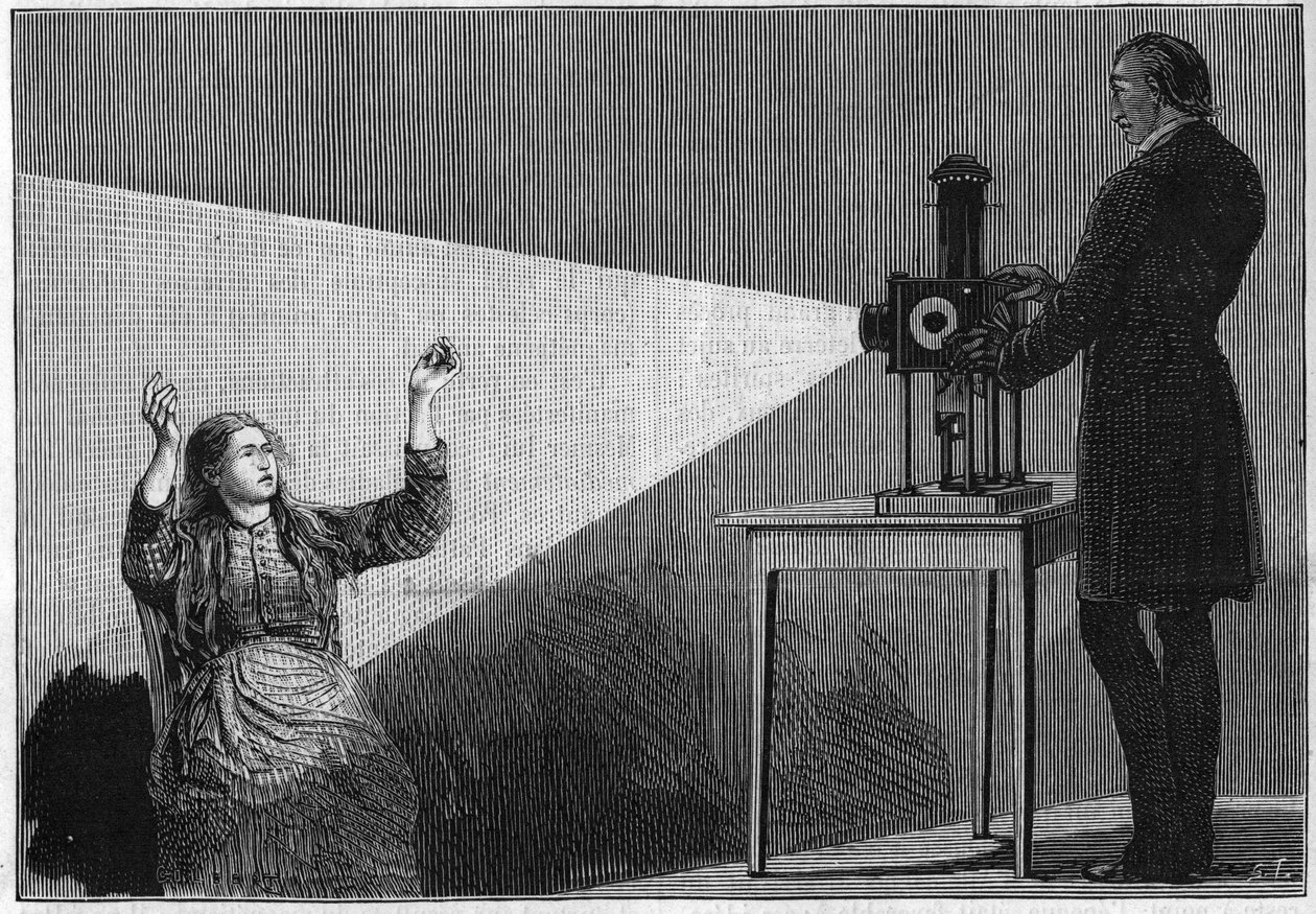 Valon vaikutuksesta syntynyt katalepsia. Ranskalainen neurologi Jean Martin Charcot (1825-1893) tutkii hypnoosin ilmiötä potilaalla Salpetrieren sairaalassa. tekijältä Unknown artist
