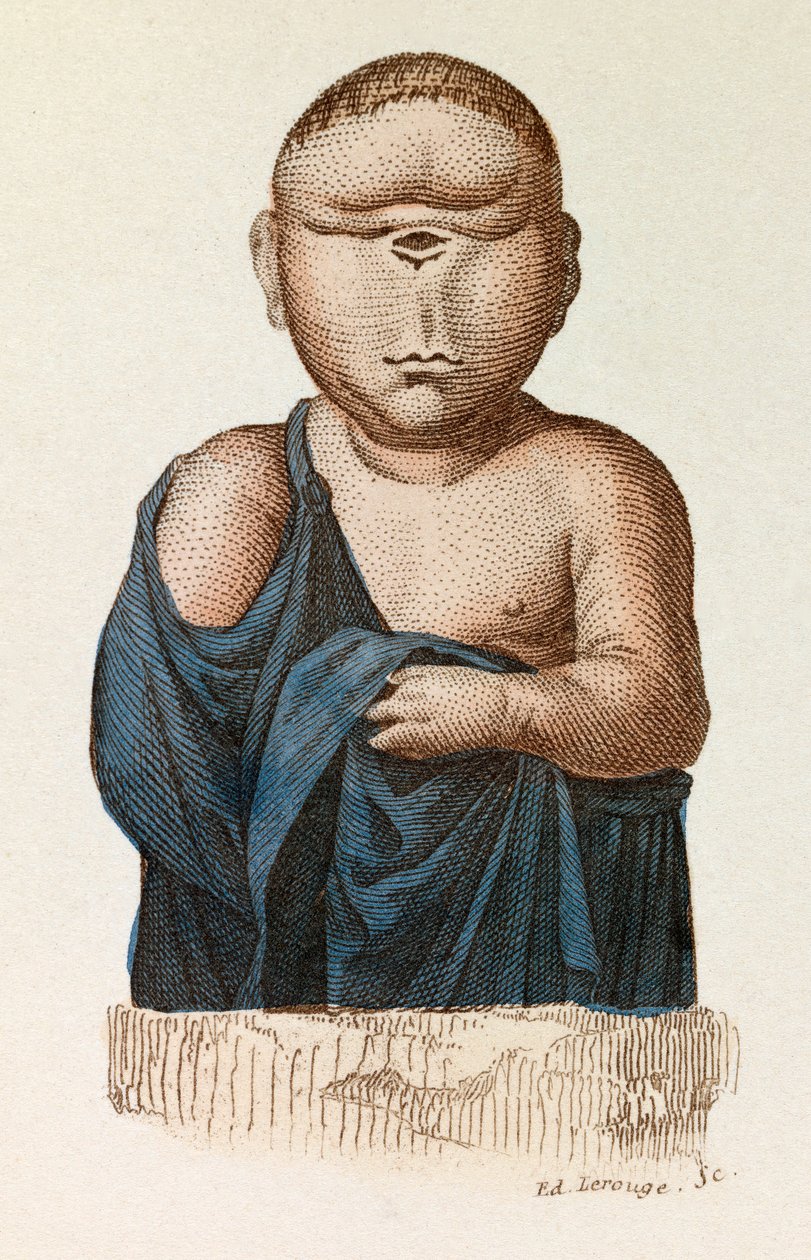 Lapsi, jolla on yksi silmä, luokiteltu Linneenen nomenklatuurin ja Cuvierin luokituksen mukaan (kaiverrus). tekijältä Unknown artist