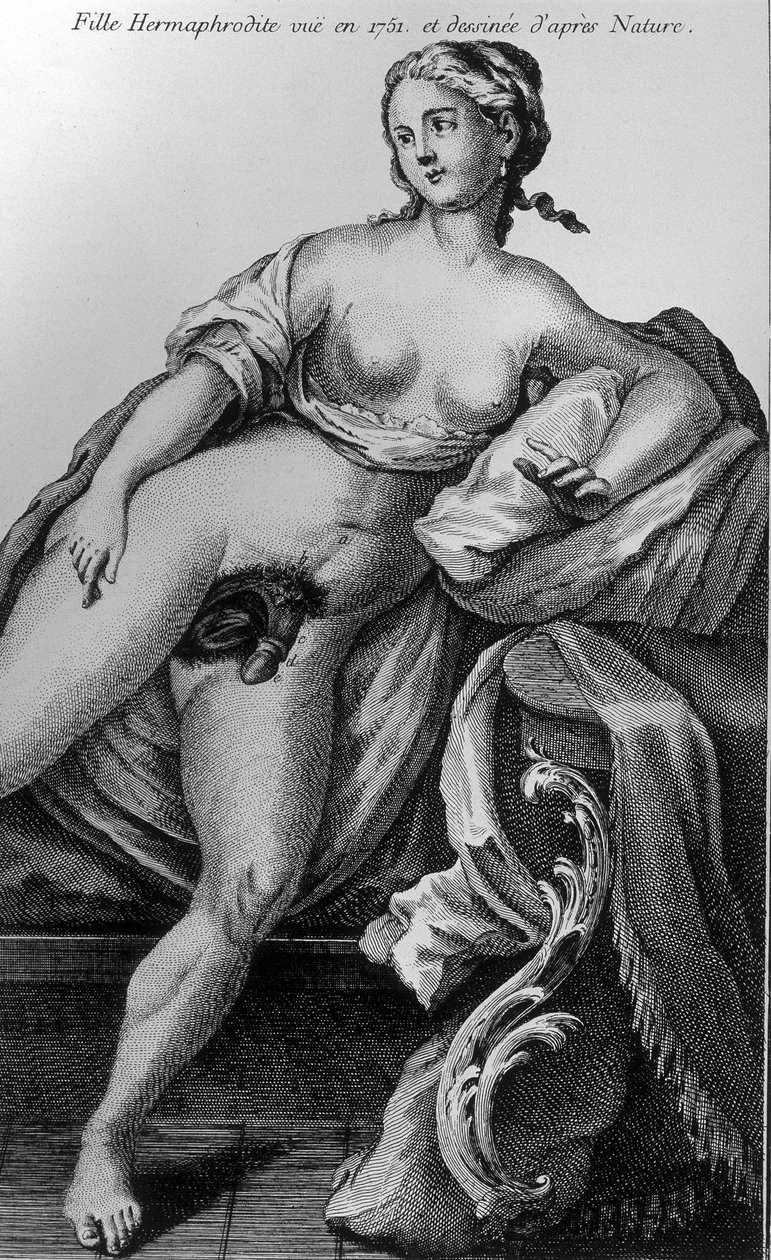 Hermafrodiittityttö nähty vuonna 1751 ja piirretty luonnosta. tekijältä Unknown artist