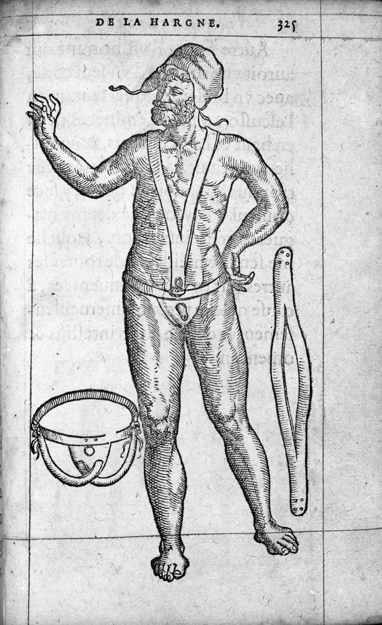 Lääketiede: hernial vyö. Ranskalaisen lääkärin ja kirurgin Ambroise Paren (1509-1590) kaiverrus ”De la hargne” 1500-luvulla tekijältä Unknown artist