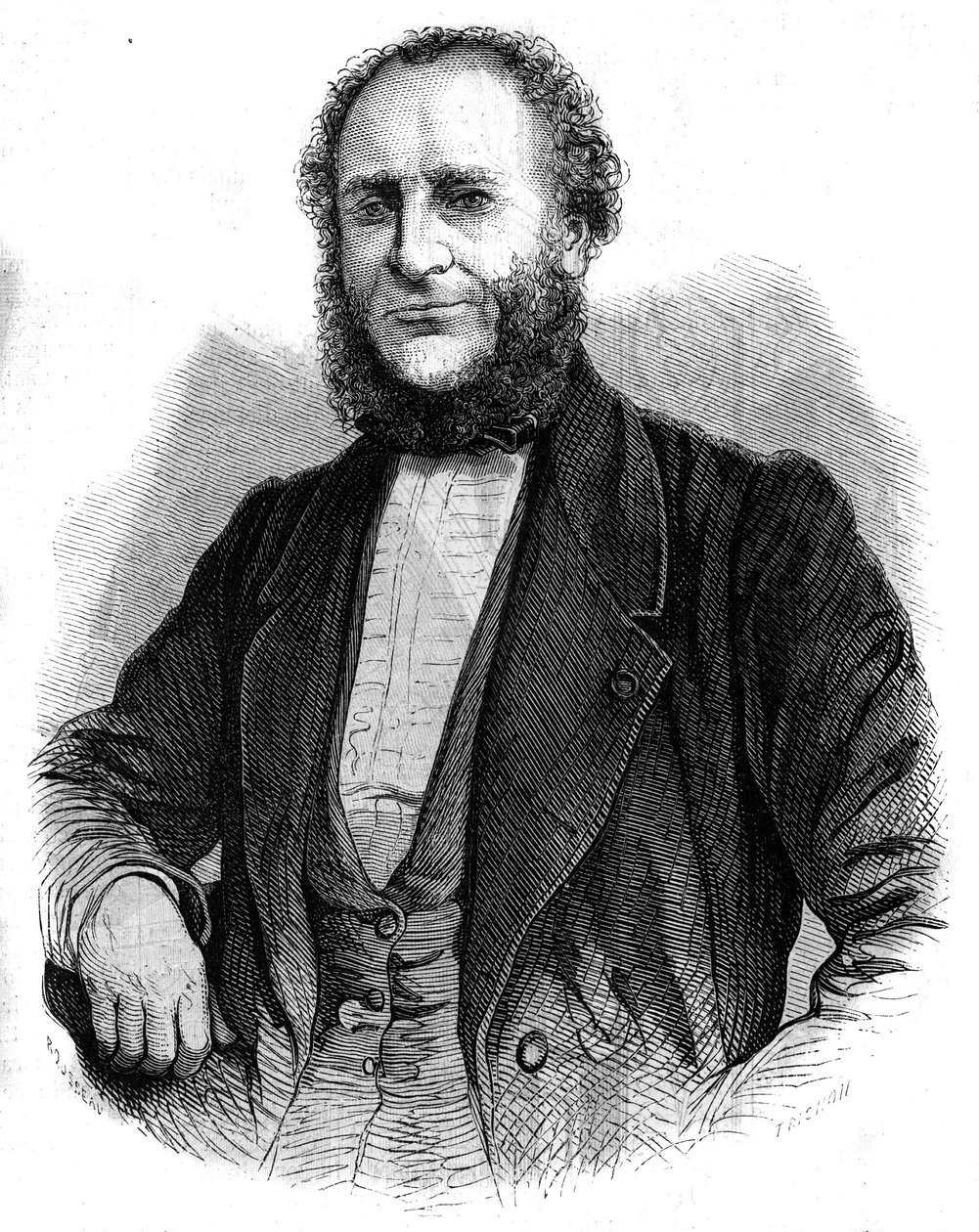 Tohtori Jobert de Lamballen (1799-1867) ranskalaisen kirurgin muotokuva. Kaiverrus "" L