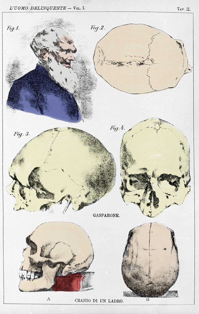 Italialaisen kriminologin tutkimus rikollisen kallon morfologiasta tekijältä Unknown artist