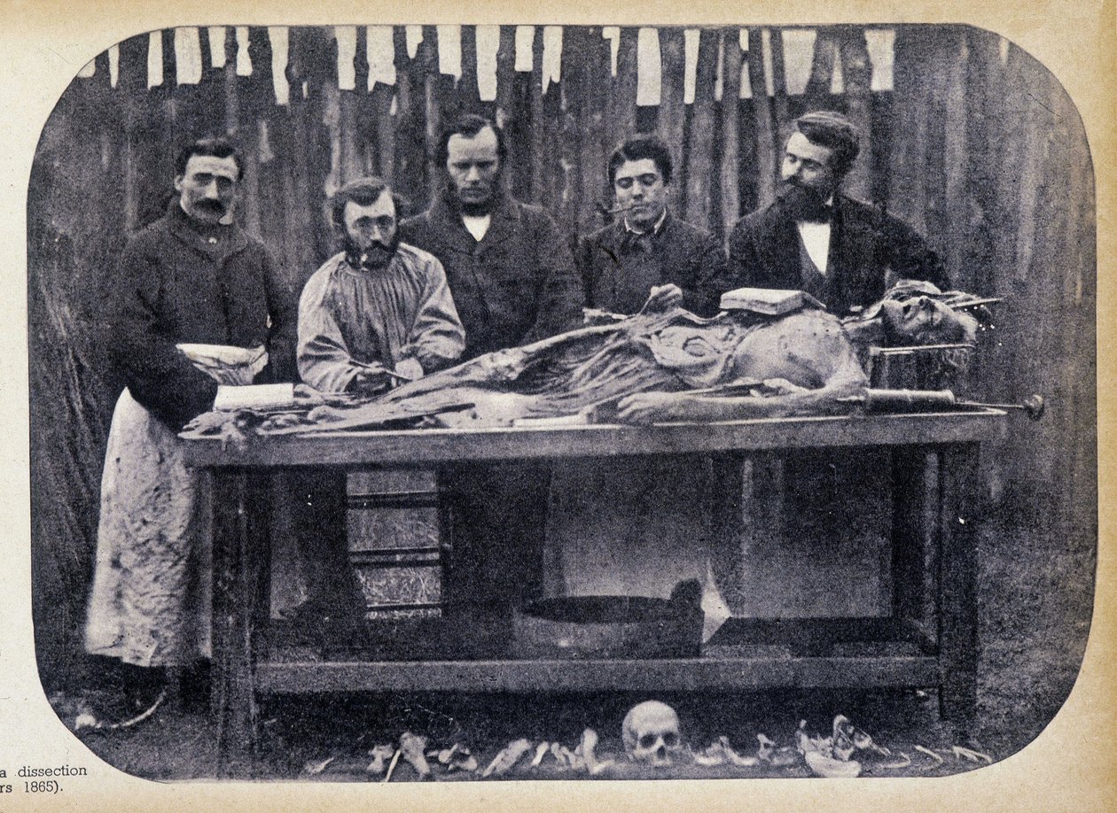 Dissection, v.1865. tekijältä Unknown photographer
