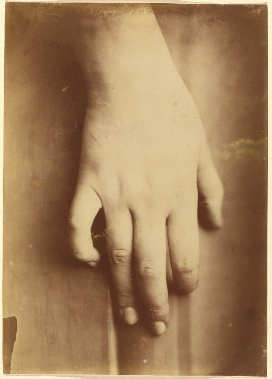 Tutkimus kädestä,1865 (kuva) tekijältä Unknown photographer