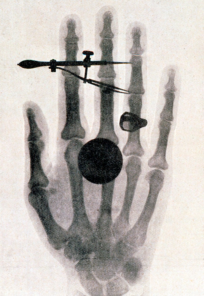 Wilhelm Roentgenin röntgenkuva vaimonsa kädestä, 1896 tekijältä Wilhelm Conrad Rontgen