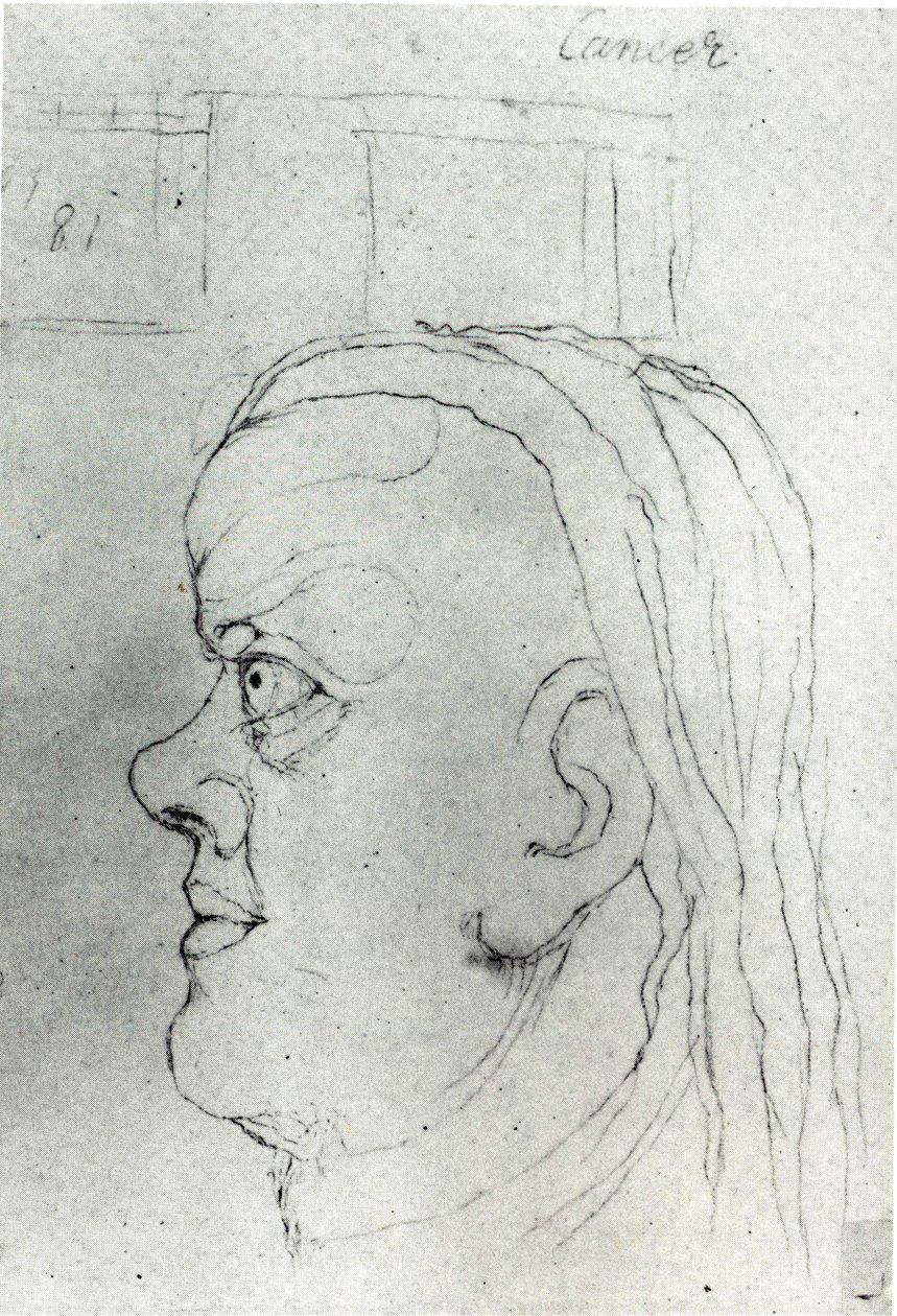 Syövän pää tekijältä William Blake