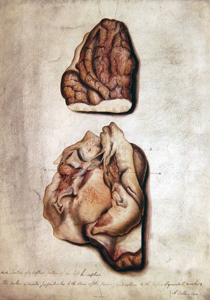 Aivotutkimus III, noin 1850 (vesiväri paperille). tekijältä William Lover