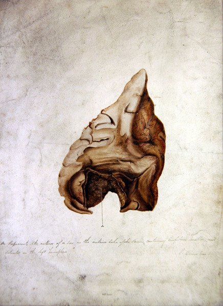 Study of Brain I, n. 1850 (akvarelli paperille) tekijältä William Lover