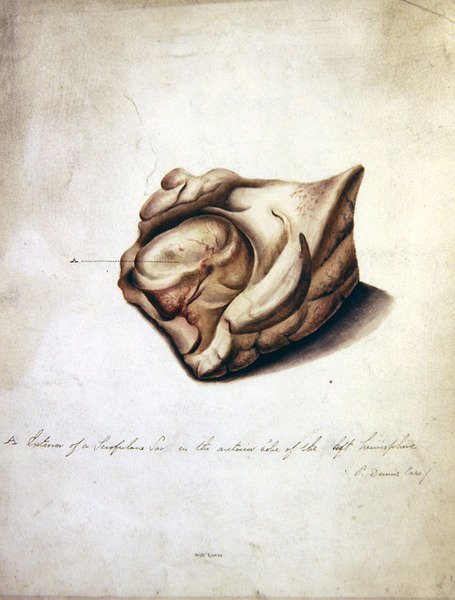 Study of the Brain II, n. 1850 (akvarelli paperille) tekijältä William Lover