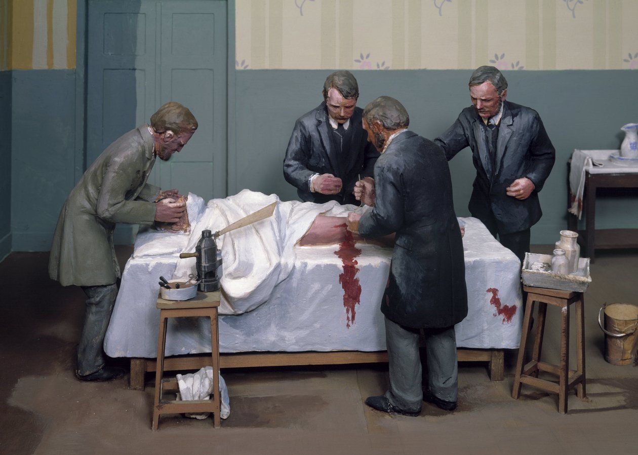 Kirurgiset antiseptit Antiseptinen toimenpide tekijältä Ferdinand Georg Waldmuller
