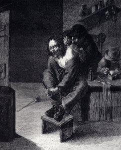 Kirurginen leikkaus Kaiverrus Adrien Brauwerin maalauksen jälkeen (1608) 1600-luku tekijältä Adriaen (after) Brouwer