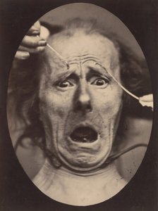 Electro-Physiologie, kuva 64, 1854-56, painettu 1862.