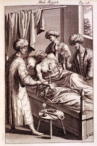Prospero Alpinuksen kuva moksibustiosta Medicina Aegyptorumista, 1745 tekijältä American School