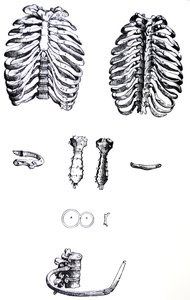 Lautaset De Humani Corporis Fabrican ensimmäisestä kirjasta tekijältä Andreas Vesalius