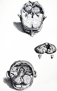 Lautaset De Humani Corporis Fabrican seitsemännestä kirjasta tekijältä Andreas Vesalius