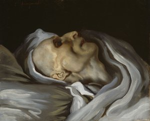 Théodore Géricault kuolinsängyssä