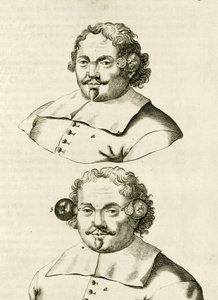 Esimerkki kuppauksesta, Frederik Dekkerin teoksesta The Practice of Medicine, 1694 tekijältä Dutch School