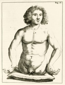 Frederik Dekkers, 1694, esimerkki synnynnäisistä epämuodostumista tekijältä Dutch School