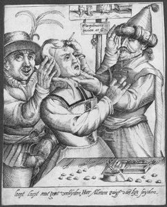 Trepaning, kaiverrus H. Weydmans (1500-luku) tekijältä Dutch School
