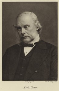 Joseph lister tekijältä English Photographer