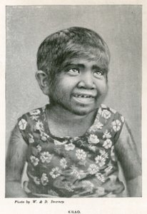 Krao, The Missing Link, esillä Aquariumissa, Westminster, Lontoo, vuonna 1887 tekijältä English Photographer