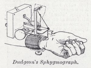 Dudgeonin sfygmografi (litho) tekijältä English School