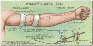 Tourniquet, nro 11 Willss-savukekorttien First Aid -sarjasta, 1913 tekijältä English School