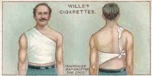 Kolmikulmainen side rintakehään, nro. 37 Willss Cigarettes -korttien First Aid -sarjasta, 1913 tekijältä English School