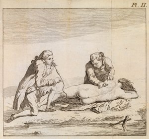 Fumigaattorin käyttö tupakan savun puhaltamiseksi hukkuneen naisen suolistoon elvytyksen helpottamiseksi, noin 1790 (kaiverrus). tekijältä English School