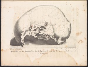 Pyhän Rumboldin kallo, 1825 Kuvaus St. Rumolduksen lantiosta sellaisena kuin se on Reliquie-Kasissa (esineessä otsikko)
