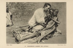 Lähetyssaarnaaja hoitaa spitaalisia tekijältä French Photographer