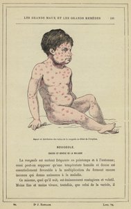 Tuhkarokkopilkkujen ulkonäkö ja jakautuminen purkauksen alkaessa (väri litho) tekijältä French School
