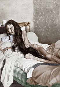 Blanche Monnier sairaalassa, Poitiers, kesäkuu 1901 (printti). tekijältä French School