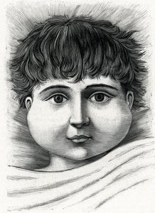 Lapsi, jolla on sikotauti (kaiverrus) 1888 tekijältä French School