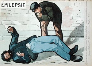"Akuutin alkoholismin aiheuttama epilepsiakohtaus", tohtori Galtier-Boissieren seinäkuva alkoholismin vaaroista, 1800-luvun loppu. (väri lito) tekijältä French School