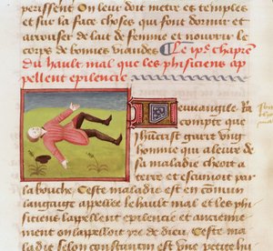 Ms 22532 Potilas, joka kärsii epilepsiakohtauksesta, Barthelemy langlaisin teoksesta The Book of the Properties of Things, c. 1410-15 tekijältä French School