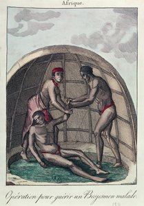 Leikkaus sairaan bushmanin parantamiseksi, 1811 (värikaiverrus) tekijältä French School